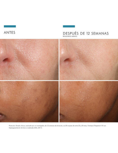 SKINCEUTICALS PHLORETIN CF, 30 ML