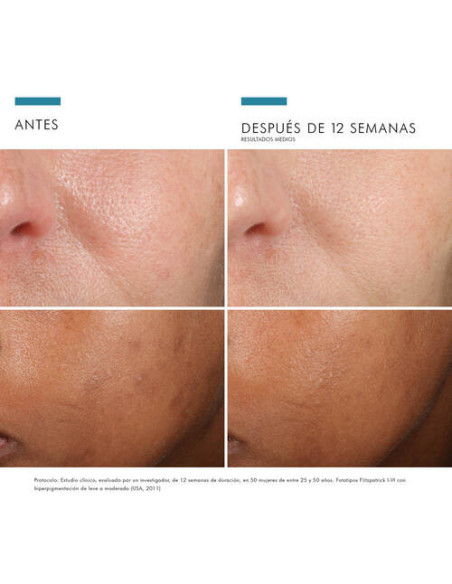 SKINCEUTICALS PHLORETIN CF, 30 ML