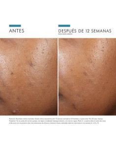 SKINCEUTICALS PHYTO A+ BRIGHTENING TREATMENT, 30 ML 2