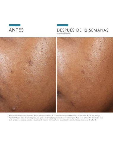 SKINCEUTICALS PHYTO A+ BRIGHTENING TREATMENT,...