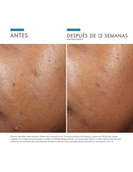 SKINCEUTICALS PHYTO A+ BRIGHTENING TREATMENT, 30 ML