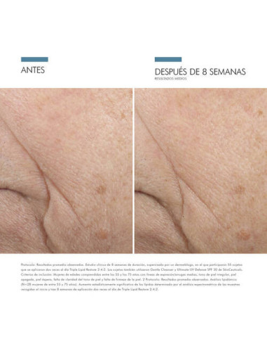 SKINCEUTICALS TRIPLE LIPID RESTORE, 48 ML