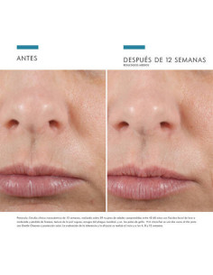 SKINCEUTICALS H.A. INTENSIFIER 30 ML 2