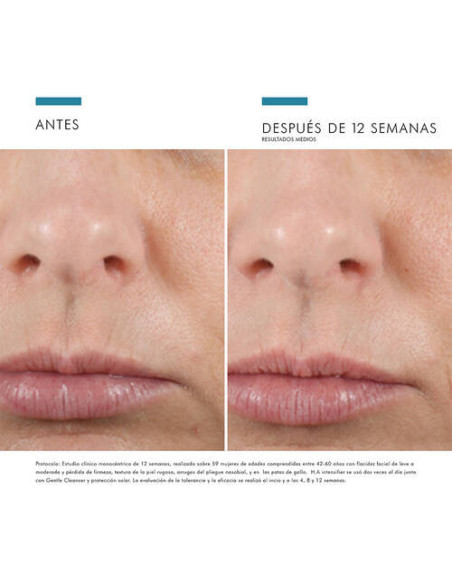 SKINCEUTICALS H.A. INTENSIFIER 30 ML