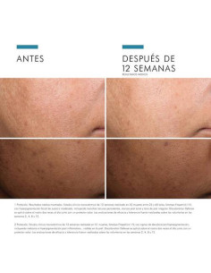 SKINCEUTICALS DISCOLORATION DEFENSE SERUM, 30 ML 2