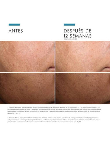 SKINCEUTICALS DISCOLORATION DEFENSE SERUM, 30 ML