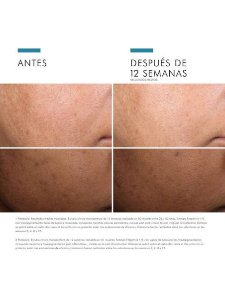 SKINCEUTICALS DISCOLORATION DEFENSE SERUM, 30 ML