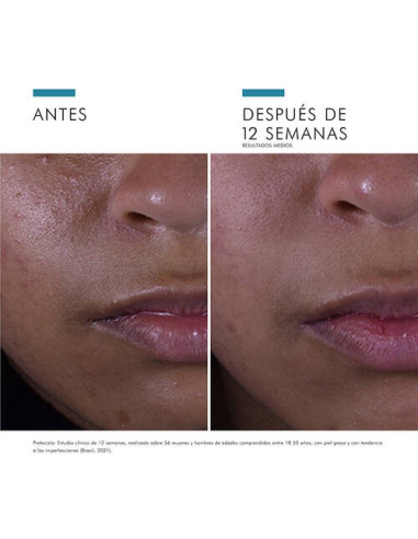 SKINCEUTICALS SILYMARIN CF, 30 ML