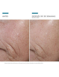 SKINCEUTICALS C E FERULIC CON 15% DE VITAMINA C, 30 ML 2