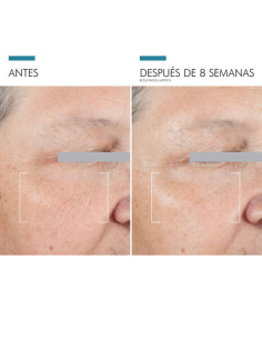 SKINCEUTICALS A.G.E. ADVANCED EYE, 15 ML