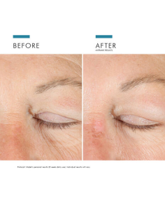 SKINCEUTICALS A.G.E. ADVANCED EYE, 15 ML