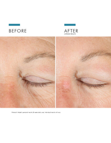 SKINCEUTICALS A.G.E. ADVANCED EYE, 15 ML