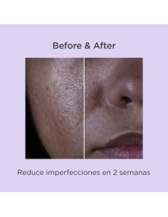 ISDINCEUTICS SALICYLIC RENEWAL, 30 ML 2