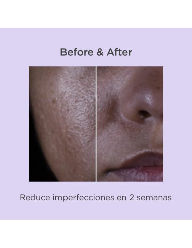 ISDINCEUTICS SALICYLIC RENEWAL, 30 ML