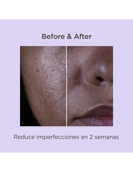 ISDINCEUTICS SALICYLIC RENEWAL, 30 ML