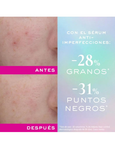 Serum Nuxe Zinc Power 30 ml Anti-imperfecciones