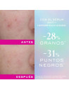 Serum Nuxe Zinc Power 30 ml Anti-imperfecciones