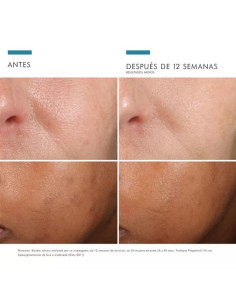 Cofre Phloretin + HA Intensifier + Advanced Brightening UV Defense