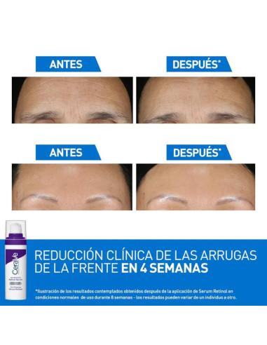 Sérum Antiedad con Retinol CeraVe Skin Renewing...