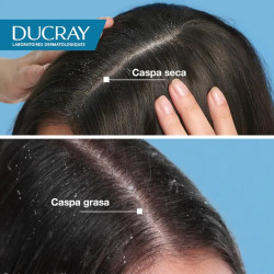 Loción Anticaspa Ducray Squanorm 200ml