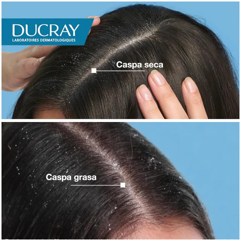 Loción Anticaspa Ducray Squanorm 200ml