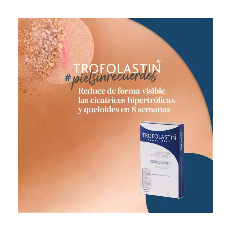 Trofolastin 5 uds Reductor de Cicatrices 5x7,5cm