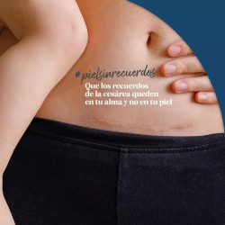 Trofolastin 5 uds Reductor de Cicatrices 5x7,5cm