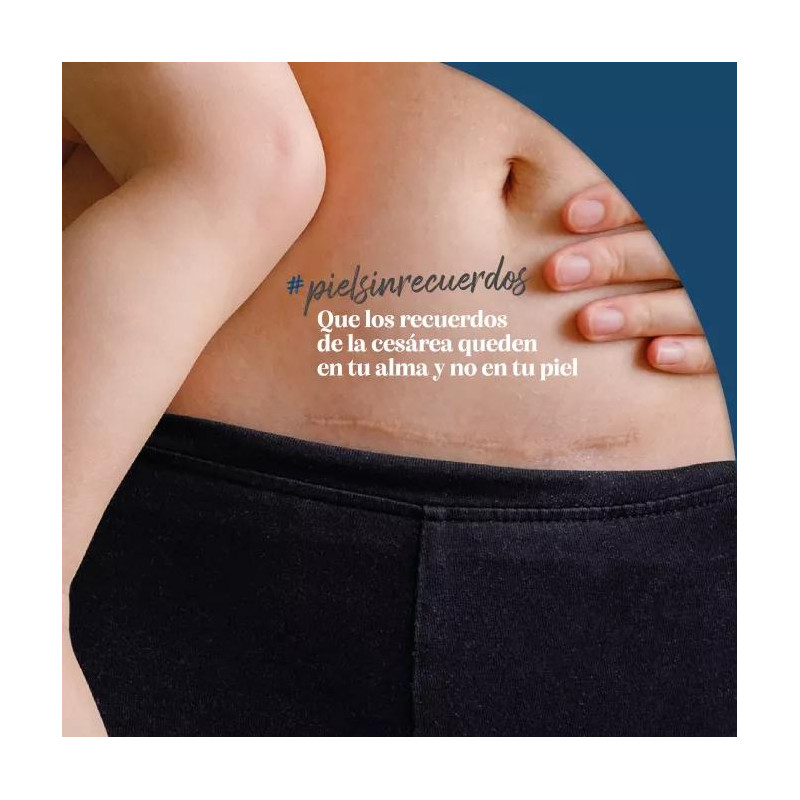 Trofolastin 5 uds Reductor de Cicatrices 5x7,5cm