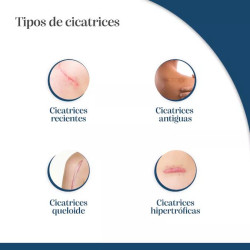 Trofolastin 5 uds Reductor de Cicatrices 5x7,5cm