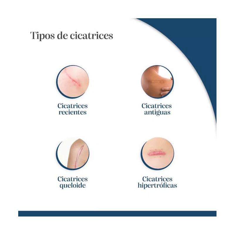 Trofolastin 5 uds Reductor de Cicatrices 5x7,5cm